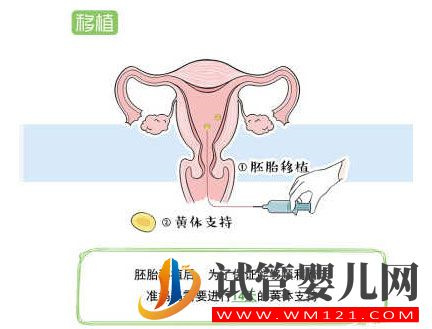 試管嬰兒流程步驟說明 試管嬰兒流程步驟說明(圖8)