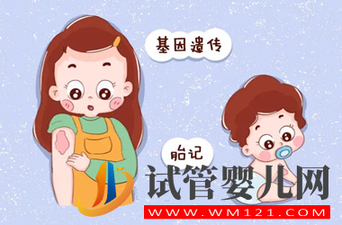 胎記遺傳的可能性大嗎?試管嬰兒會(huì)長(zhǎng)胎記嗎?(圖1)