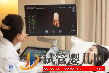 image.png 四維單子上3個亮點是男孩 思維單子怎么看男看女(圖2)