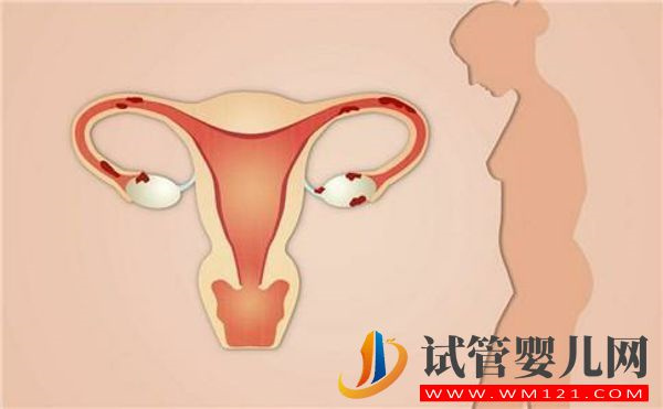 子宮切除的好處、壞處大盤點，這8大后遺癥有重大危害(圖2)