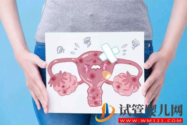 卵巢囊腫對(duì)試管助孕有影響嗎？聽聽專家怎么說(圖3)