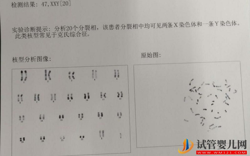 男性染色體異常是可以做試管嬰兒的嗎?(圖1) 男性染色體異常是可以做試管嬰兒的嗎?(圖1)