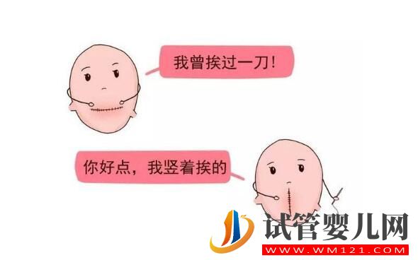 女人多少歲后不能做試管嬰兒？(圖4)