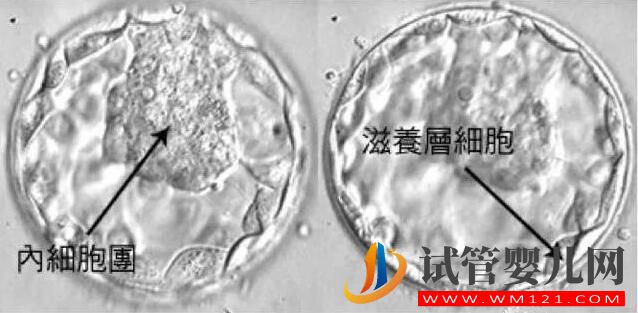試管嬰兒胚胎選擇看“顏值”，長得好看才能被移植！(圖5)