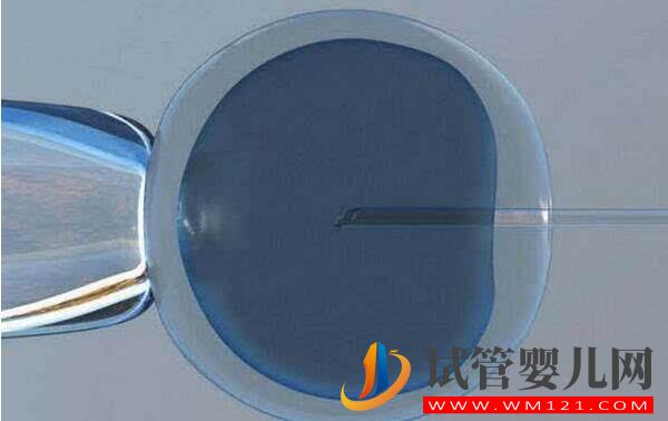 哪些情況?會建議做試管？做試管嬰兒緩解壓力的方式(圖3)