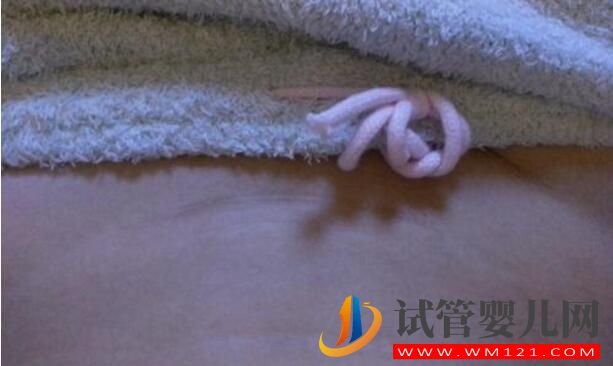 有過剖腹產做試管嬰兒可以懷雙胞胎嗎?要需要休息多久能做(圖3) 有過剖腹產做試管嬰兒可以懷雙胞胎嗎?要需要休息多久能做(圖3)