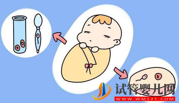 試管嬰兒是在哪里長(zhǎng)大的？是在試管里長(zhǎng)大的嗎？(圖4)