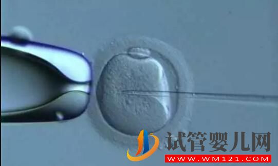 試管嬰兒做一代好還是二代好？(圖2)