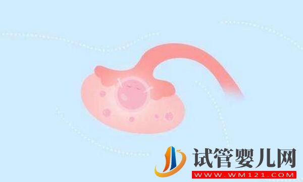 做試管嬰兒促排出現空卵泡是為什么?該怎么辦(圖3) 做試管嬰兒促排出現空卵泡是為什么?該怎么辦(圖3)