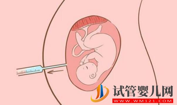 女性40歲適合做試管嬰兒嗎?做試管需要注意什么(圖3) 女性40歲適合做試管嬰兒嗎?做試管需要注意什么(圖3)