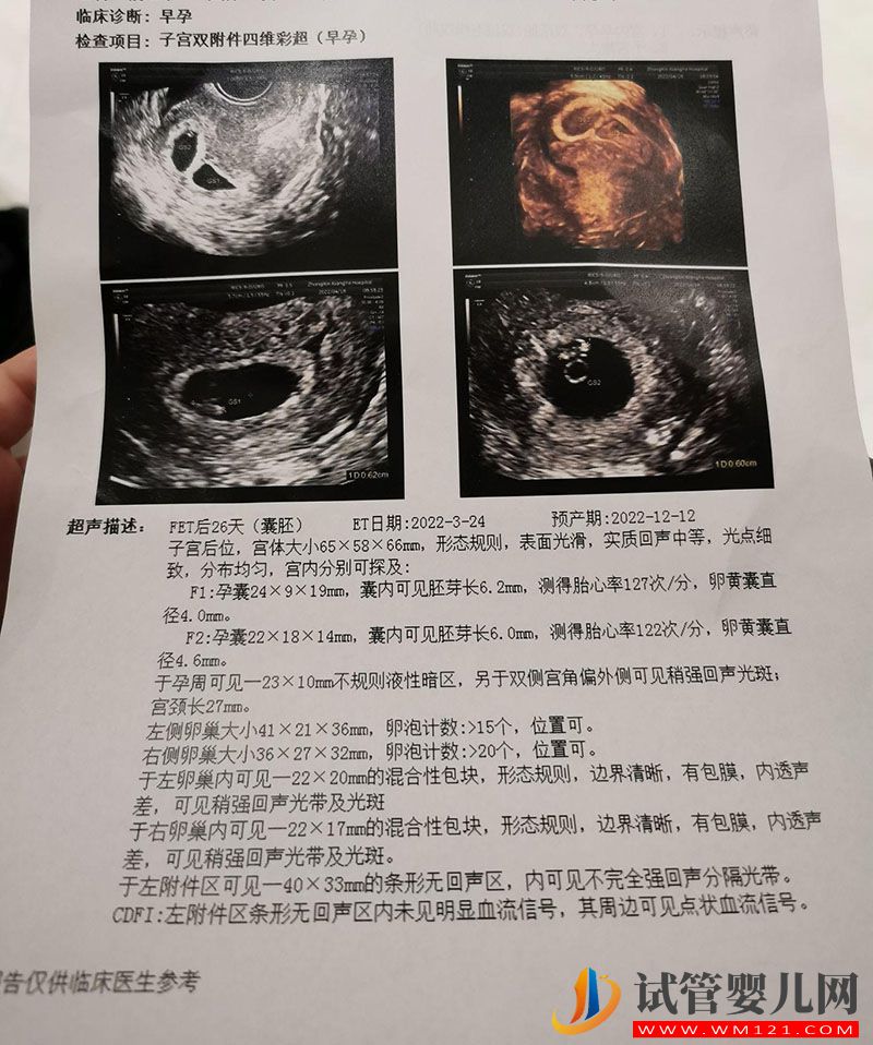 包生男孩就找第三代試管是真的嗎?(圖1) 包生男孩就找第三代試管是真的嗎?(圖1)