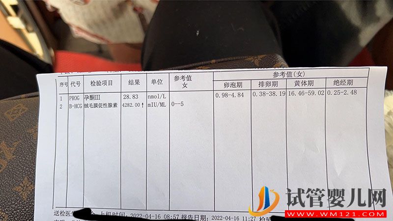 朋友給供卵做試管要多少錢(圖1)