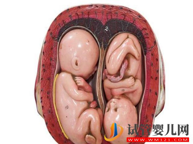 什么時間同房最容易懷雙胞胎呢？(圖1)