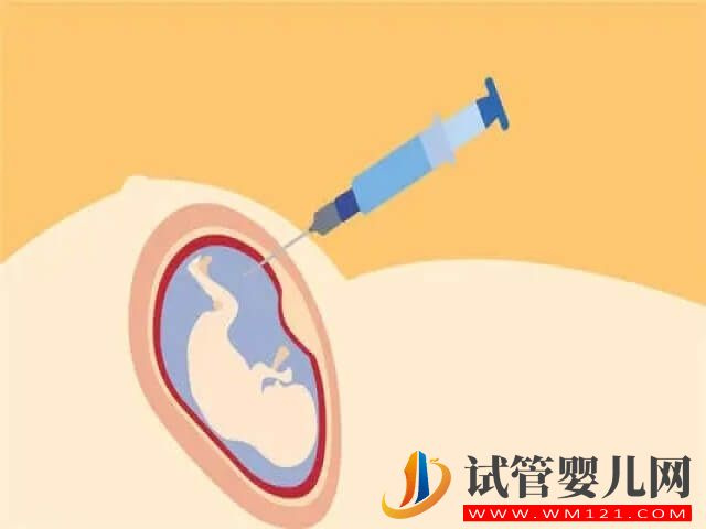 雙胞胎除了唐篩，還有哪些產檢做不了？(圖2)