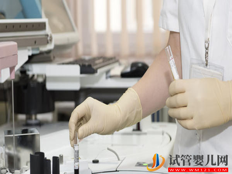 洗精術(shù)不適合所有艾滋病患者(圖1)