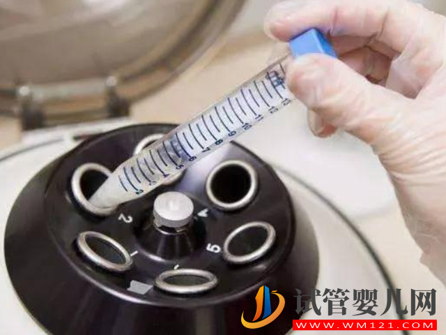 國內男方hiv陽性洗精需要多少錢？(圖1)