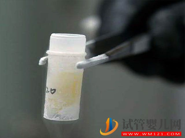 hiv患者可以在國內(nèi)洗精子嗎？(圖1)