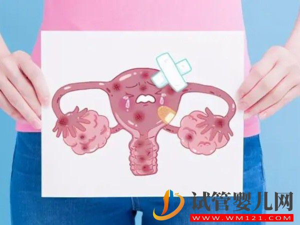 為什么很多醫(yī)生說做試管嬰兒最怕子宮內(nèi)膜異位？(圖1)