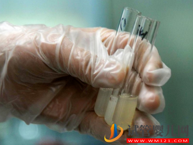 正常男性精子顏色對照表，發黃發紅都要警惕起來(圖2)