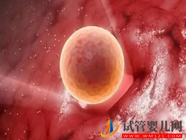 男人弱精還能做試管嬰兒?jiǎn)?圖2) 男人弱精還能做試管嬰兒?jiǎn)?圖2)