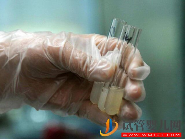 做試管精子卵子取出來后可在自然環境下放多久？(圖1)