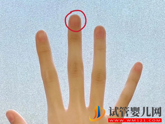 孕期掐中指看男女真的準(zhǔn)，在家自測掐這個(gè)部位一猜一個(gè)準(zhǔn)(圖2)