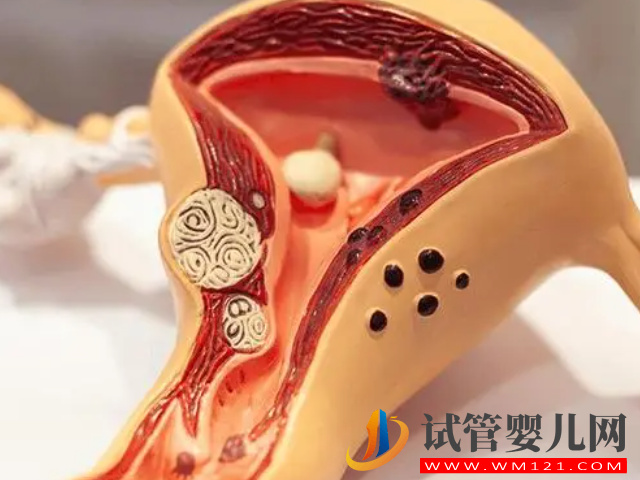 內(nèi)膜薄必吃的4種促生長中藥方子分享，還您一片肥沃的土壤(圖2)