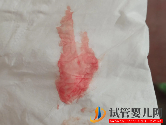 試管移植停藥后出血要警惕，小心是流產(chǎn)、胎停找上門(mén)！(圖2)