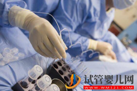 做試管嬰兒，從哪些方面選擇醫院_(圖1)