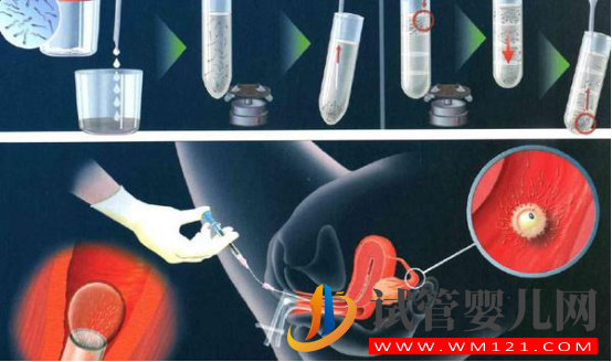 為什么說肥胖會造成不孕不育？(圖1)