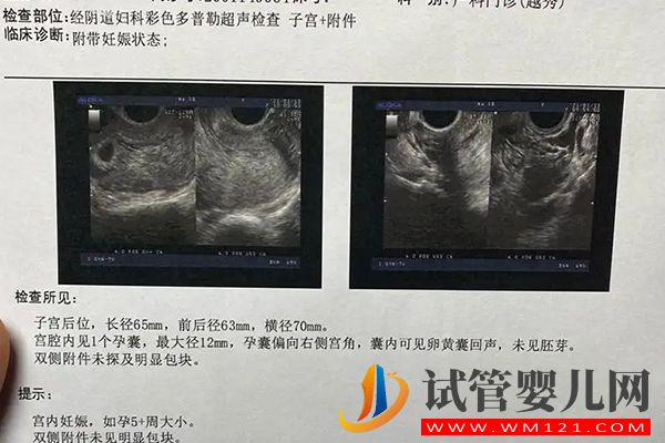 自貢檢查卵泡做b超還是陰超視情況而定，但這3點區別要知曉(圖3)