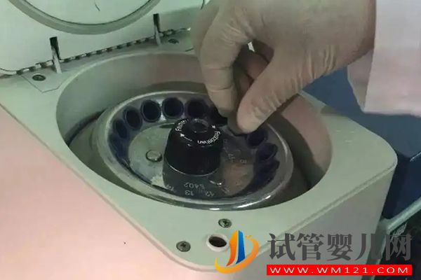 人工受孕精子挑選方法有2種，可直接打到宮頸進(jìn)行助孕(圖2)