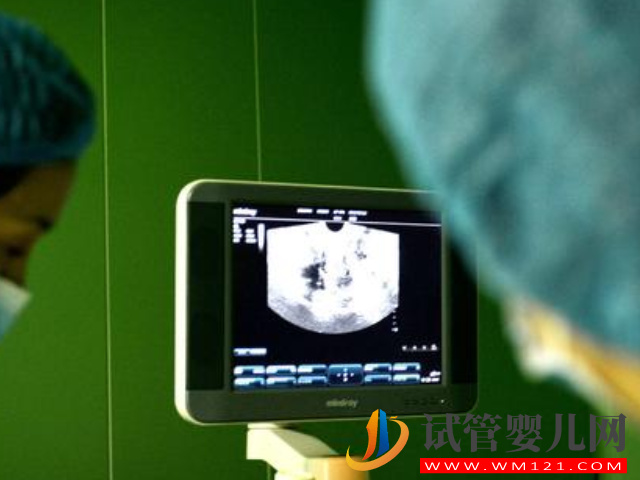 國內同志家庭生育福音,美國試管對夫妻性別無要求(圖3) 國內同志家庭生育福音,美國試管對夫妻性別無要求(圖3)