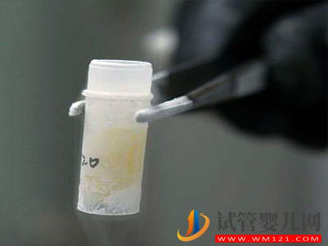 les在國外做試管生孩子需要哪些流程？(圖2)