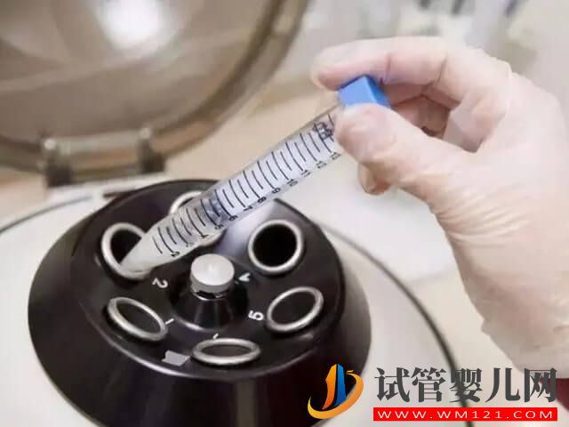 男性在泰國康民醫(yī)院做洗精的要求有哪些？(圖1)