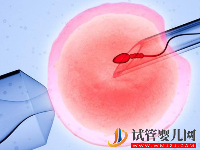 華西醫(yī)院可以為HIV做第三代試管嗎？(圖1)