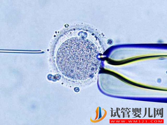 秦皇島婦幼試管嬰兒只可以做第一代嗎？(圖1)