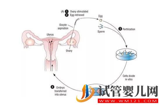 試管嬰兒移植后早期著床有什么反應呢(圖1) 試管嬰兒移植后早期著床有什么反應呢(圖1)
