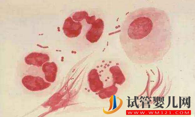 試管嬰兒前期檢查項目報告你看的懂嗎?看完就會了(圖5) 試管嬰兒前期檢查項目報告你看的懂嗎?看完就會了(圖5)