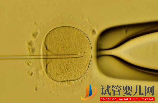 試管嬰兒鮮胚移植成功率高嗎?哪些情況不能移植鮮胚(圖1) 試管嬰兒鮮胚移植成功率高嗎?哪些情況不能移植鮮胚(圖1)