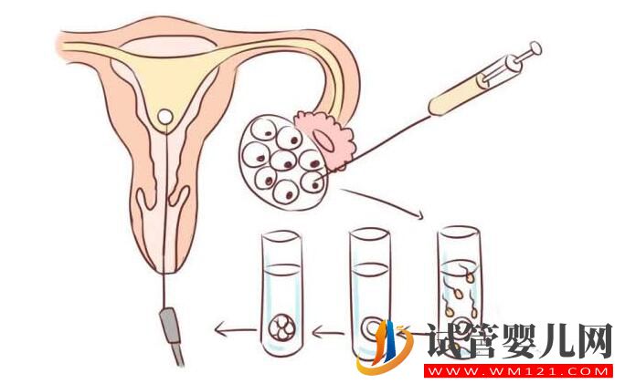 試管嬰兒移植雙胞胎好嗎？去泰國做成功率怎么樣(圖3)