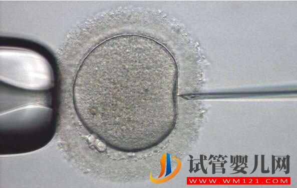 試管嬰兒促排不會選擇方案 一文加深你對促排卵方案的了(圖1) 試管嬰兒促排不會選擇方案 一文加深你對促排卵方案的了(圖1)