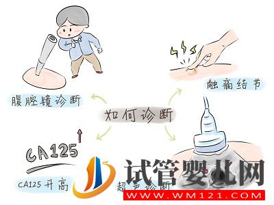 子宮內膜異位癥——痛經的一種常見病因(圖4) 子宮內膜異位癥——痛經的一種常見病因(圖4)