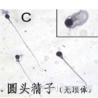 一代試管和二代試管的區別_畸形率高影響試管成功率(圖14)