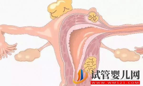 閉經是由什么原因引起的呢？閉經又和絕經有什么區別？(圖6)