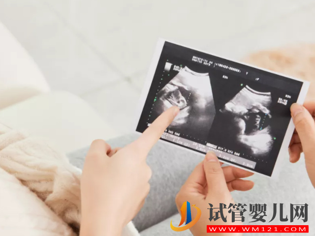四維b超單子上有男女的暗示，有這兩點(diǎn)基本是男孩了(圖2)