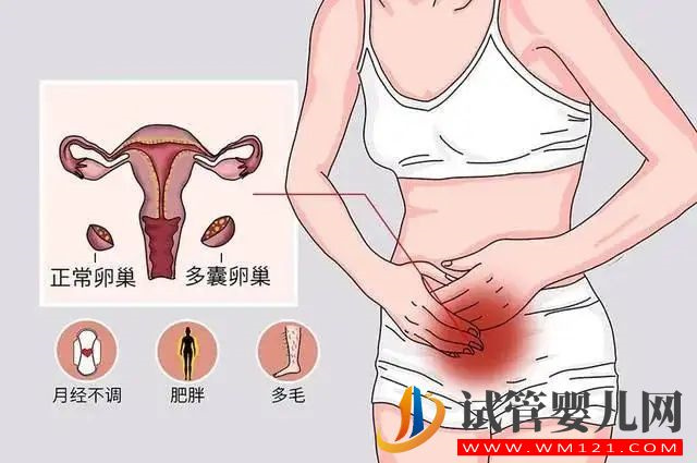 多囊卵巢的危害有哪些(圖1)