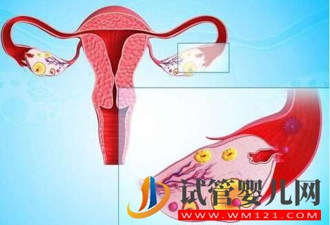 卵巢早衰怎樣調(diào)理做試管？(圖1)