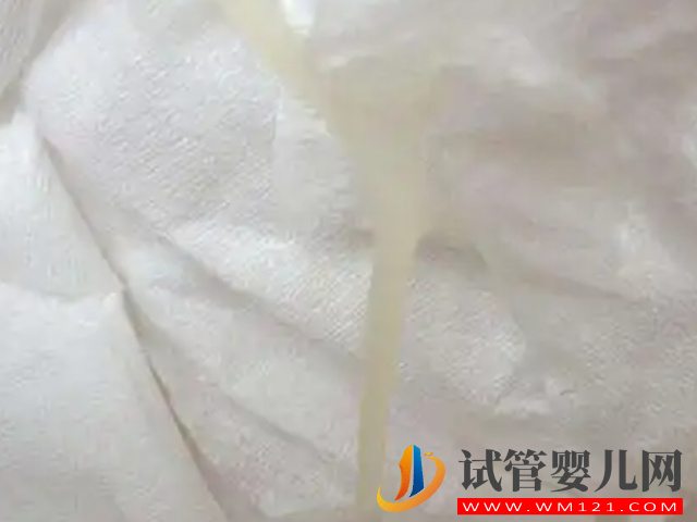 一圖看清胚胎著床成功排出的白帶表現(xiàn),呈水樣、發(fā)黃都是好“孕”(圖2) 一圖看清胚胎著床成功排出的白帶表現(xiàn),呈水樣、發(fā)黃都是好“孕”(圖2)