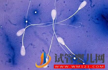 試管嬰兒的流程是怎樣的?需要做什么準(zhǔn)備?要注意什么?(圖3) 試管嬰兒的流程是怎樣的?需要做什么準(zhǔn)備?要注意什么?(圖3)